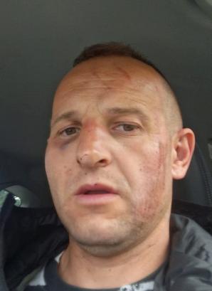 [VIDEO] Rutkowski na tropie byłych policjantów. Dariusz  Albrychowicz twierdzi, że został brutalnie pobity 